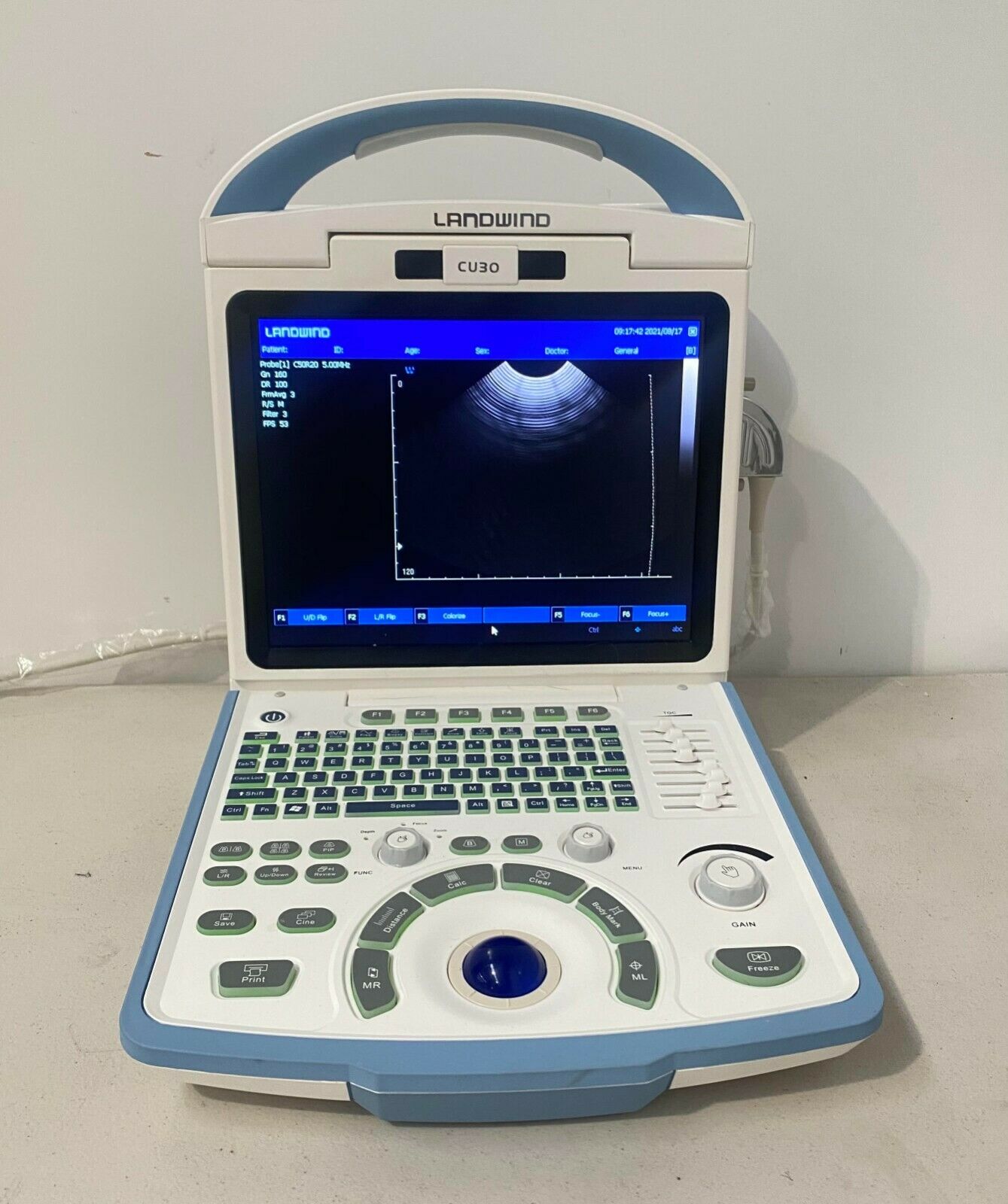 Landwind CU30 Portable Ultrasound with Micro Convex Probe DIAGNOSTIC ULTRASOUND MACHINES FOR SALE