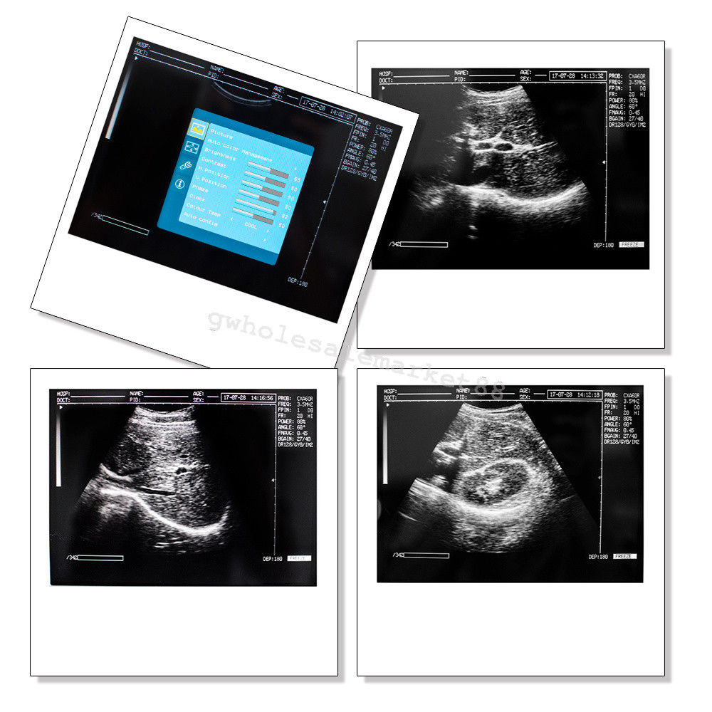 Ultrasound Machine Laptop Ultrasound Scanner Convex probe 3D Software Diagnose 190891045898 DIAGNOSTIC ULTRASOUND MACHINES FOR SALE