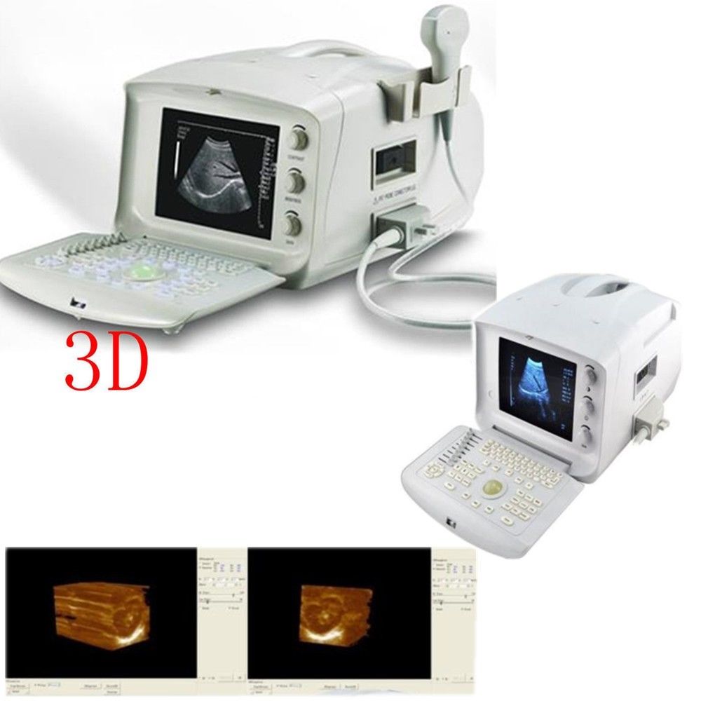 New + 3D STATION Portable Ultrasound Scanner machine Convex + Linear 2 Probes US DIAGNOSTIC ULTRASOUND MACHINES FOR SALE