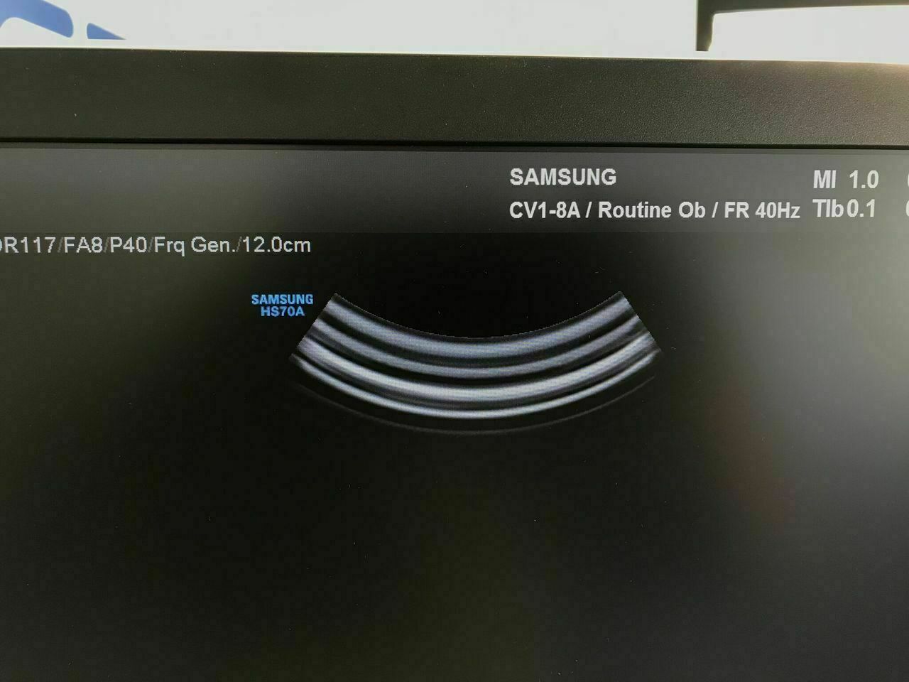 Samsung WS80A Elite Ultrasound and CV1-8 3D Abdominal with Realistic Vue DIAGNOSTIC ULTRASOUND MACHINES FOR SALE