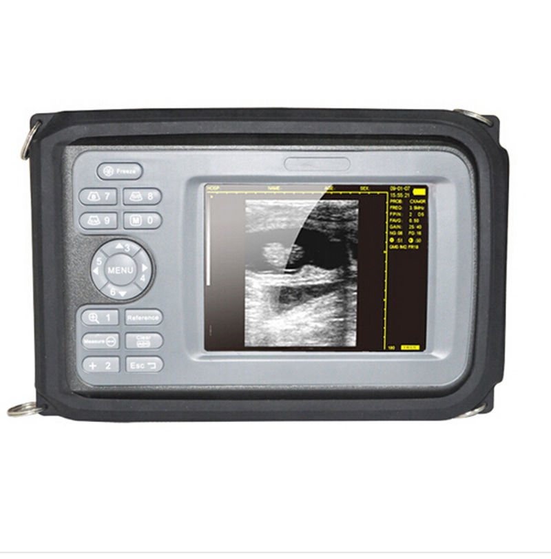 5.5" TFT Human Portable Handheld Digital Ultrasound Scanner 7.5Mhz Linear probe DIAGNOSTIC ULTRASOUND MACHINES FOR SALE