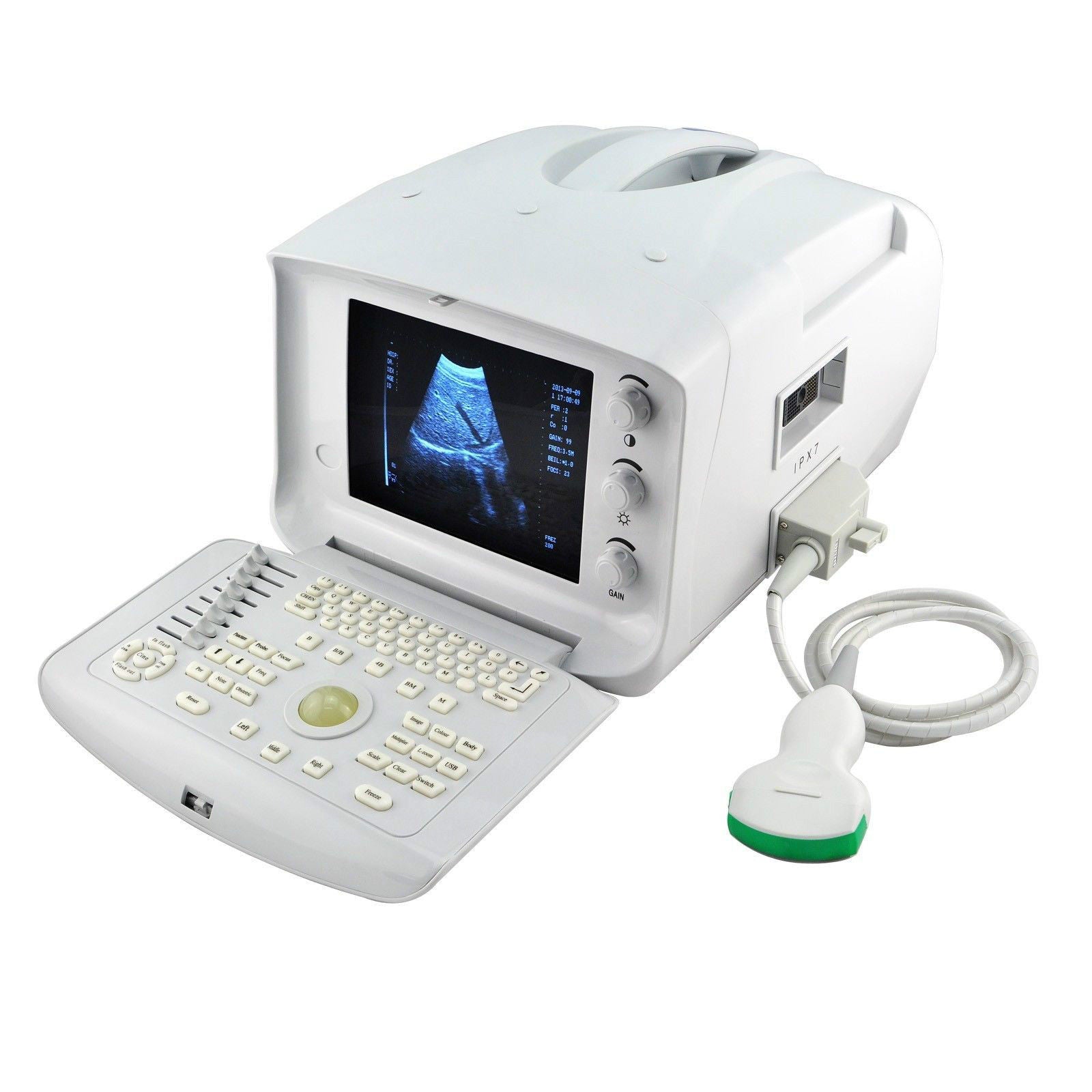 New + 3D STATION Portable Ultrasound Scanner machine Convex + Linear 2 Probes US DIAGNOSTIC ULTRASOUND MACHINES FOR SALE