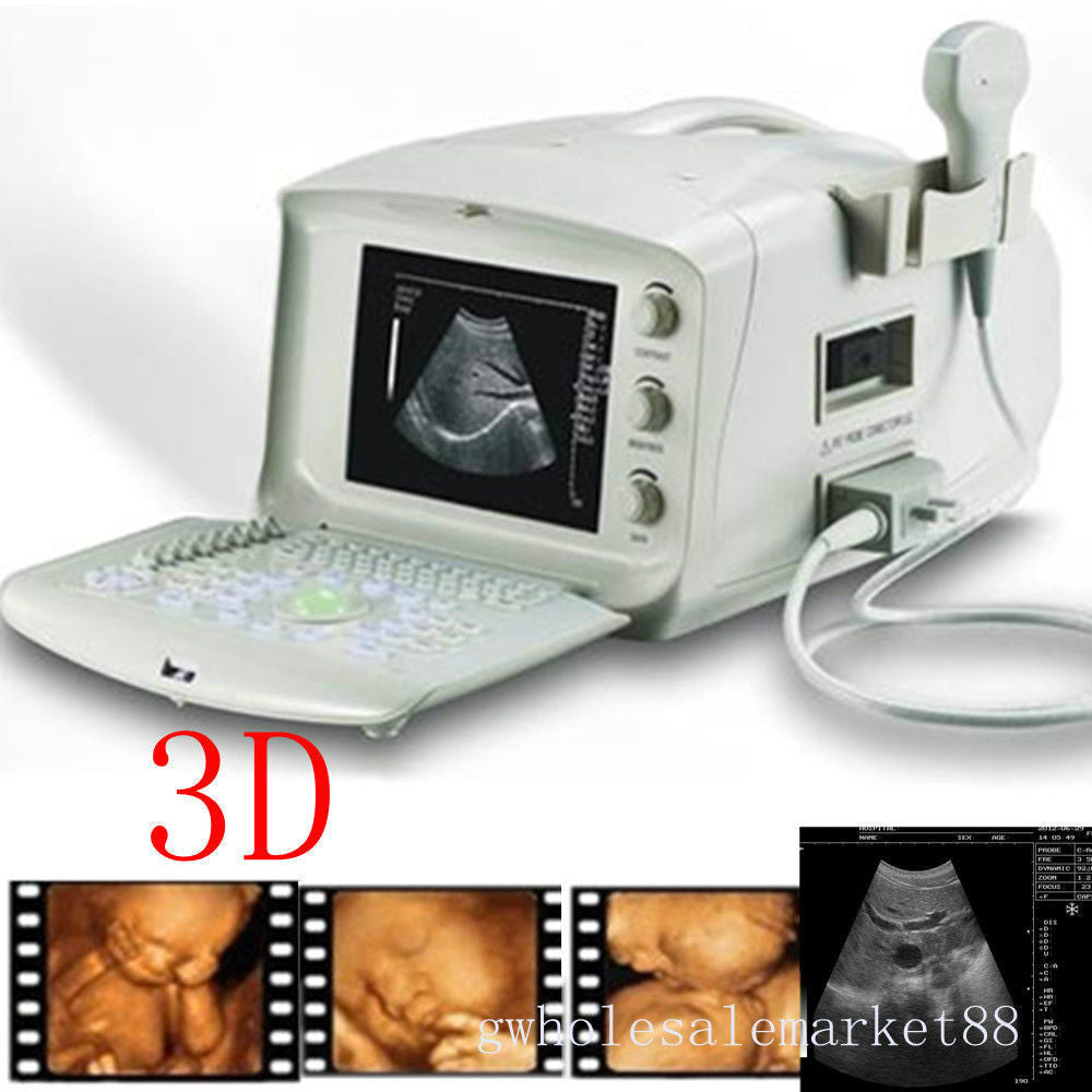 Portable Machine Digital Ultrasound Scanner Transvaginal Probe -PC 3D Software 190891732514 DIAGNOSTIC ULTRASOUND MACHINES FOR SALE