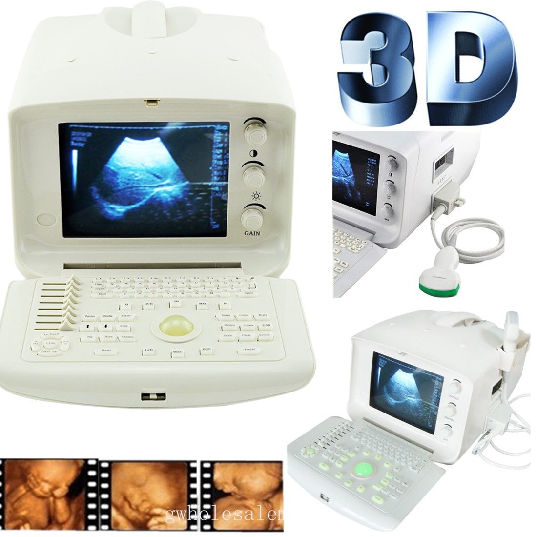 Digital Portable diagnose Ultrasound Scanner system Convex Probe+ extra 3D Gift DIAGNOSTIC ULTRASOUND MACHINES FOR SALE