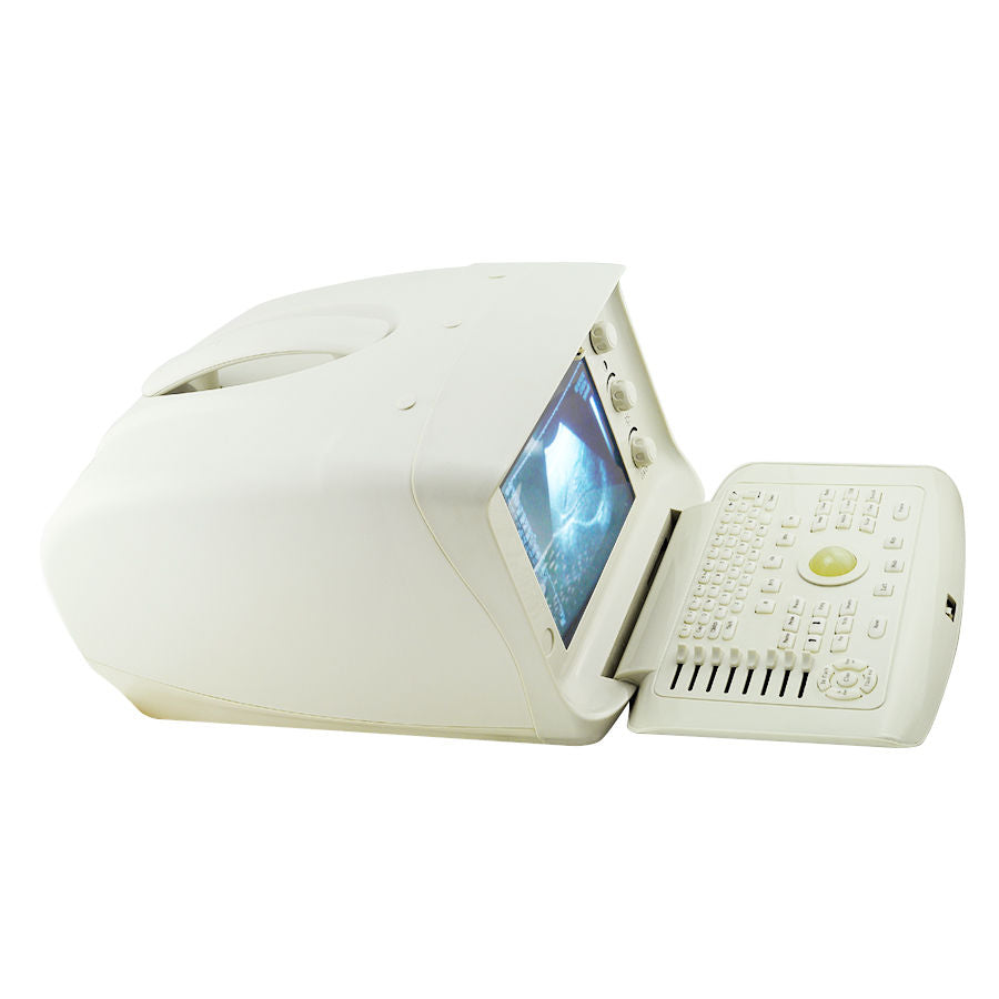 Full 3D Digital Ultrasonic Ultrasound Scanner machine Convex +Transvaginal Probe 190891404527 DIAGNOSTIC ULTRASOUND MACHINES FOR SALE