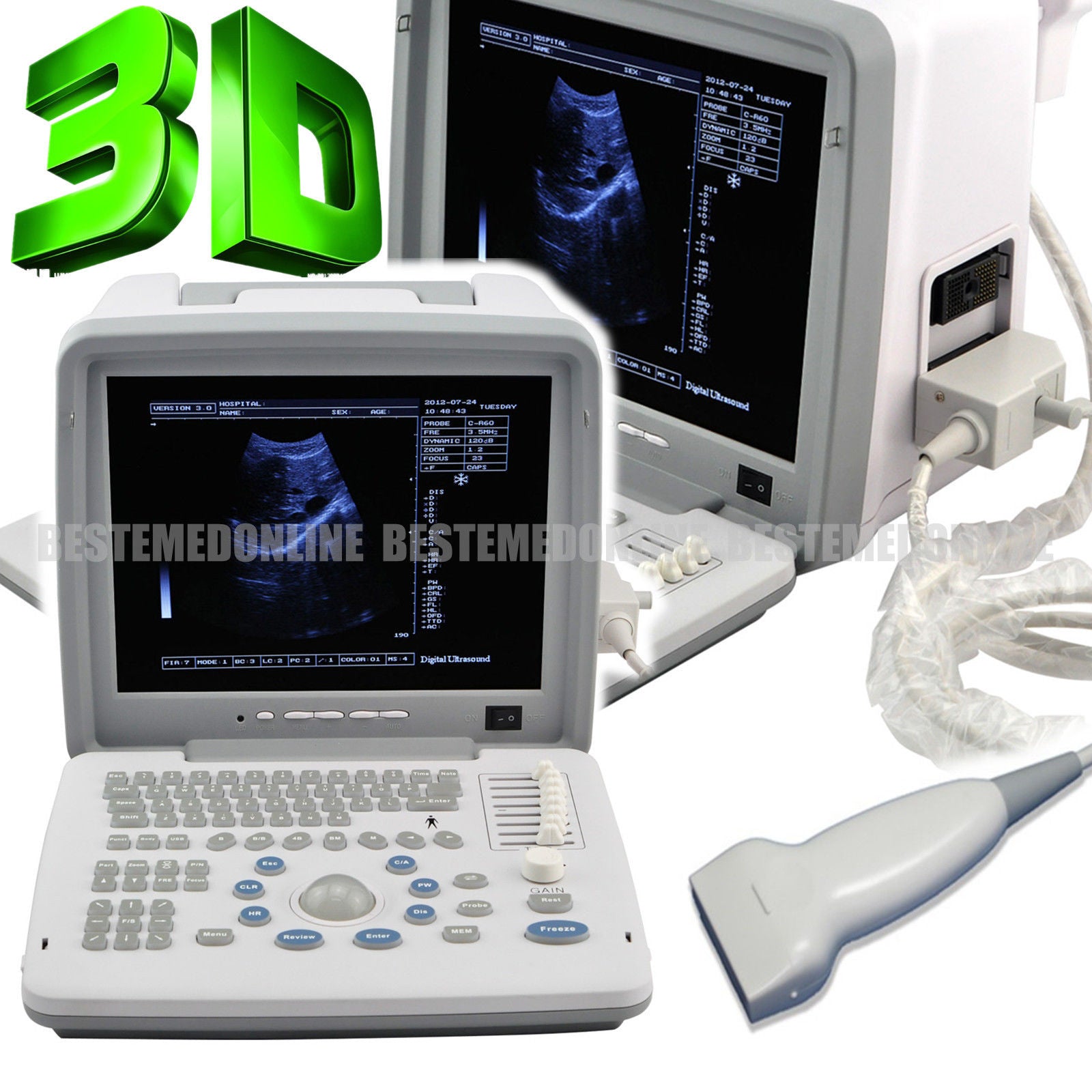 Full Digital Ultrasound Scanner System Machine 7.5 Mhz Linear Probe Clear image DIAGNOSTIC ULTRASOUND MACHINES FOR SALE