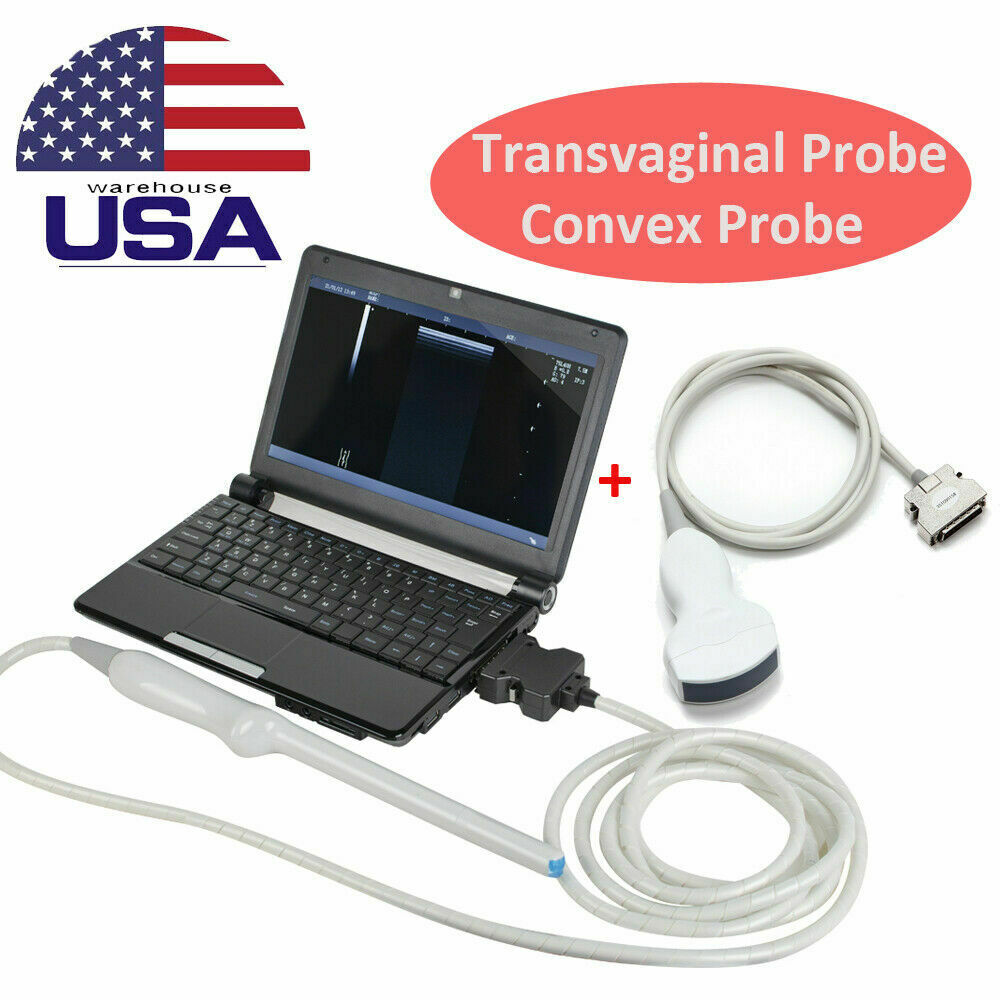 Digital Laptop Ultrasound Scanner with Transvaginal & 3.5MHz Micro Convex Probes DIAGNOSTIC ULTRASOUND MACHINES FOR SALE