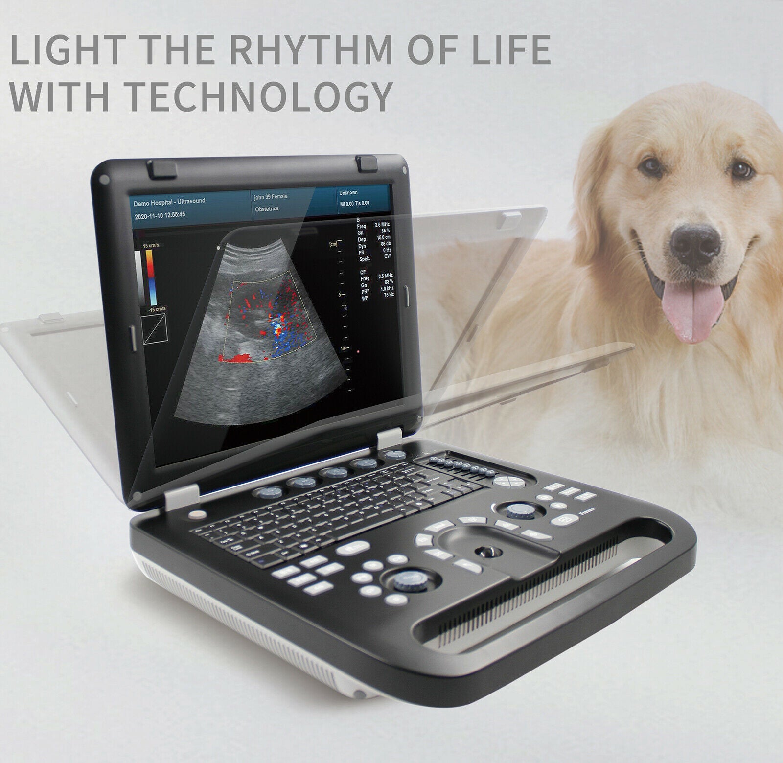 Color Doppler Veterinary Ultrasound Scanner Machine+Rectal Probe PW CW Horse/Cow 670924011996 DIAGNOSTIC ULTRASOUND MACHINES FOR SALE