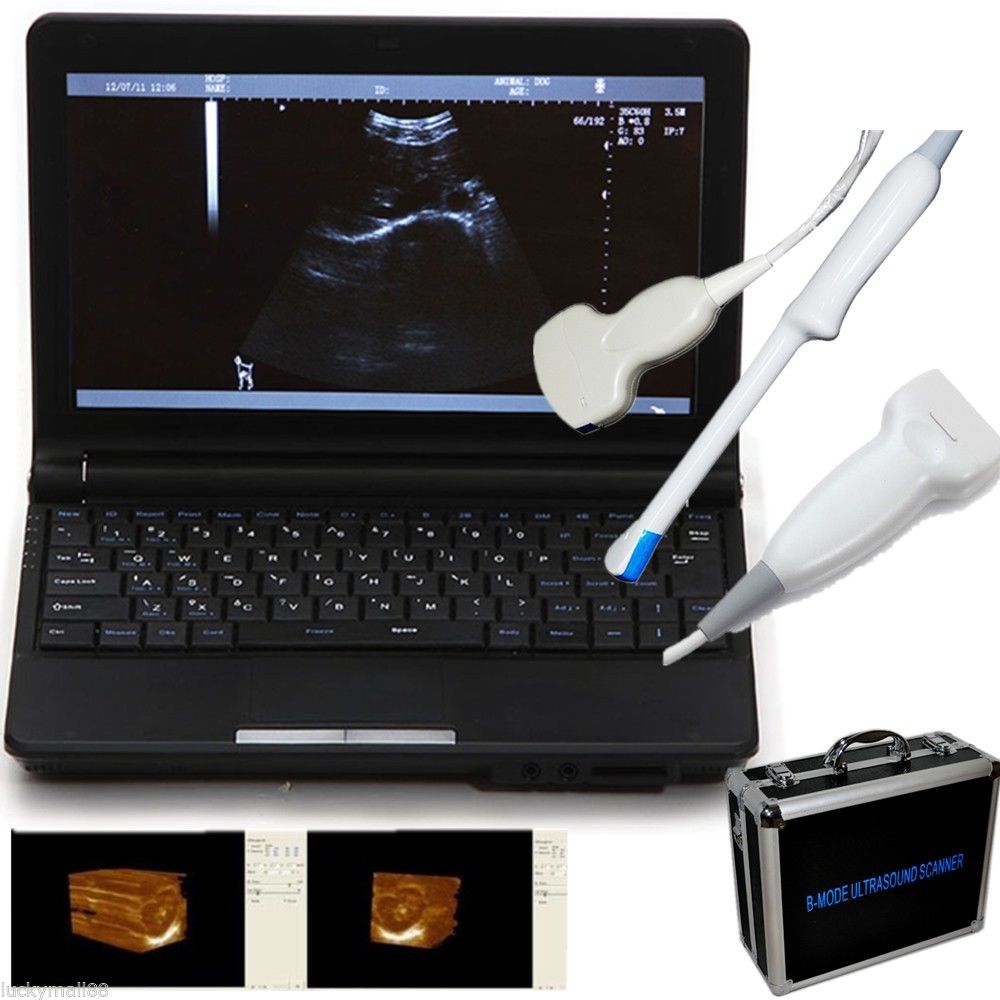 Ultrasound Scanner Machine System Convex Linear Transvaginal 3 Probe 3D Software 190891518705 DIAGNOSTIC ULTRASOUND MACHINES FOR SALE