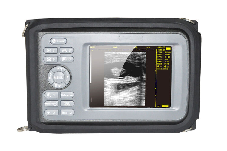 Portable Digital Ultrasound Scanner Machine Diagnostic System Cardiac 3.5 Convex DIAGNOSTIC ULTRASOUND MACHINES FOR SALE