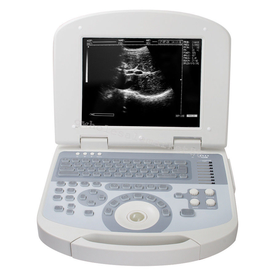 US Ultrasound Machine Laptop Ultrasound Machine Scanner Convex probe 3D Software 190891045898 DIAGNOSTIC ULTRASOUND MACHINES FOR SALE