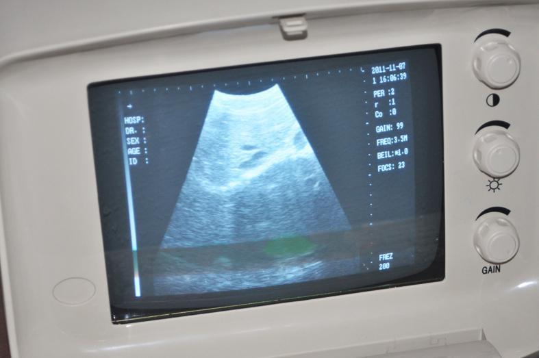 CE New Ultrasound Scanner Machine B scan + Micro-convex Probe +3D High Quality DIAGNOSTIC ULTRASOUND MACHINES FOR SALE