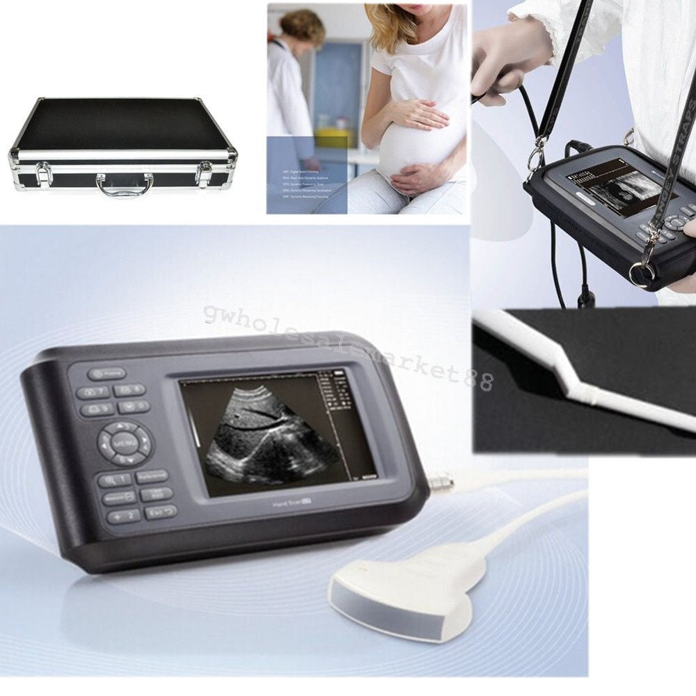 Laptop Machine Scan Digital Ultrasound Scanner Convex Linear Transvaginal Probe DIAGNOSTIC ULTRASOUND MACHINES FOR SALE