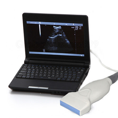 Digital Laptop Ultrasound Scanner machine system + 7.5MHZ Linear Probe Hospital DIAGNOSTIC ULTRASOUND MACHINES FOR SALE