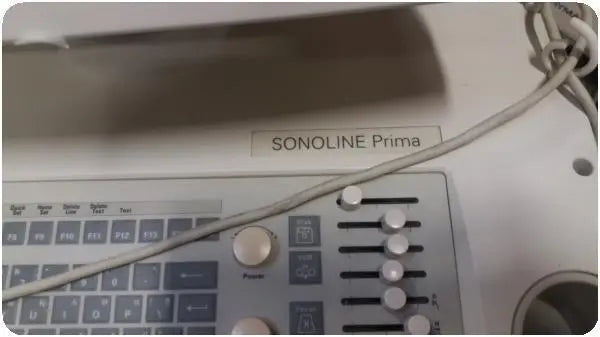 SIEMENS SONOLINE PRIMA 4900580LV300 DIAGNOSTIC ULTRASOUND MACHINE WITH PROBE% DIAGNOSTIC ULTRASOUND MACHINES FOR SALE