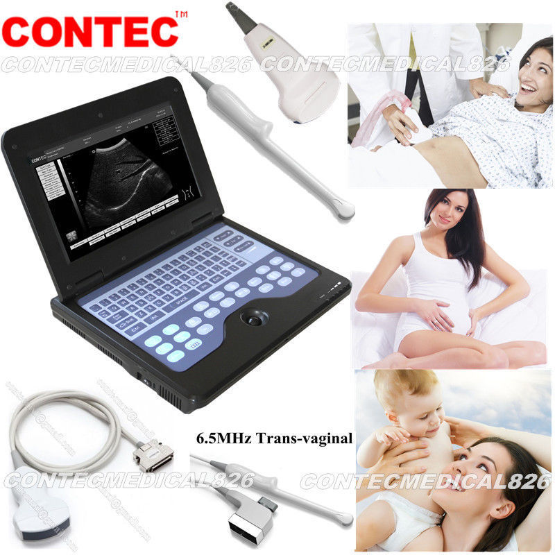 CE Portable Ultrasound Scanner Laptop Machine Diagnostic System Optional 4 Probe DIAGNOSTIC ULTRASOUND MACHINES FOR SALE