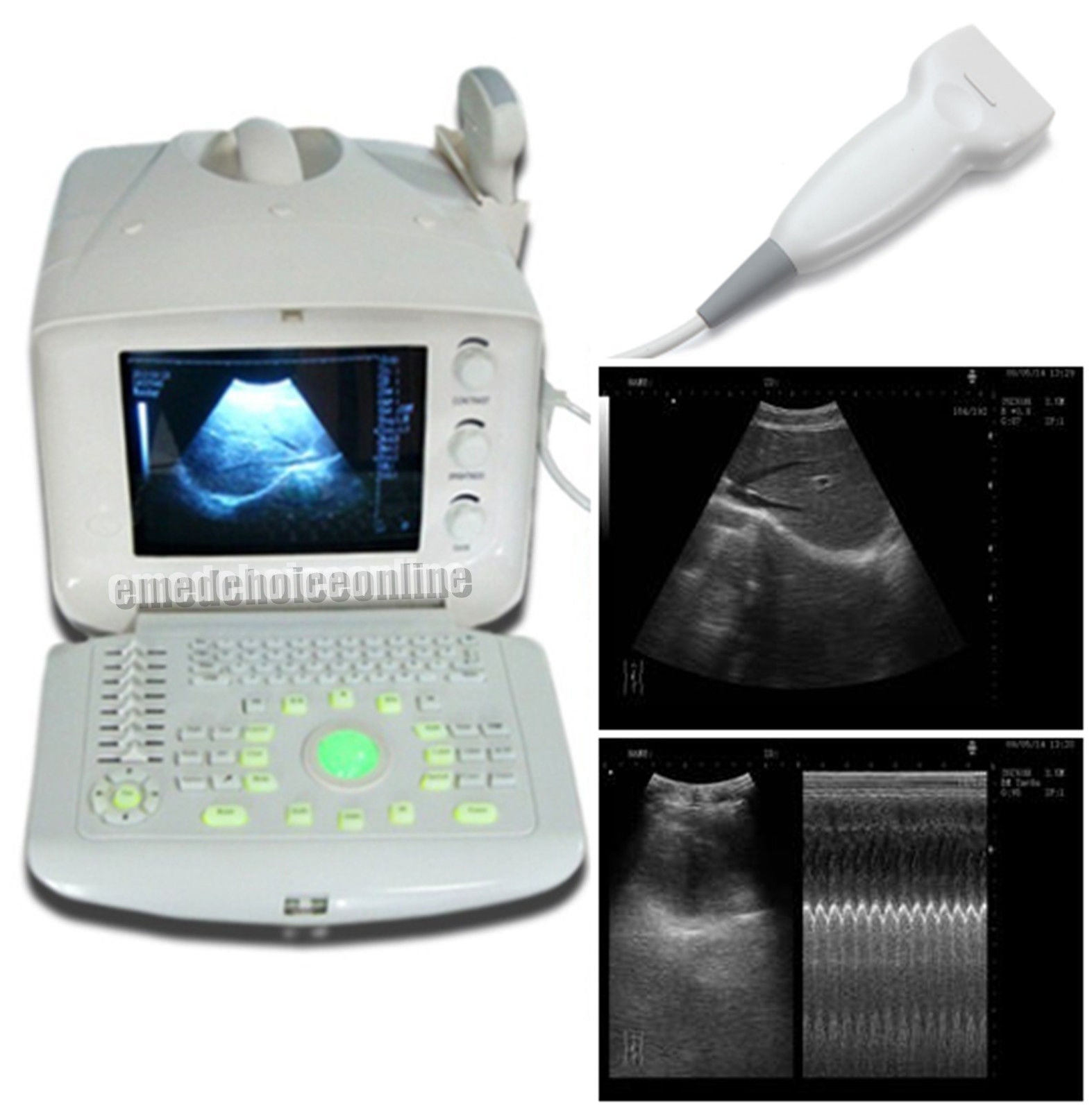 Ultrasonic Portable Ultrasound Scanner Machine & Linear probe 2 USBs+3D Update 190891370136 DIAGNOSTIC ULTRASOUND MACHINES FOR SALE