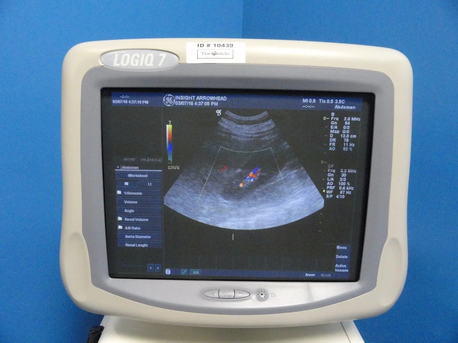 2004 GE Logiq 7 Ultrasound System W/ M12L, 3.5C Probes & B/W Printer (10439) DIAGNOSTIC ULTRASOUND MACHINES FOR SALE