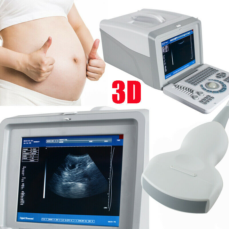 Portable Ultrasonic Ultrasound Scanner Digital 3.5MHz Convex Probe + 3D DHL/UPS DIAGNOSTIC ULTRASOUND MACHINES FOR SALE