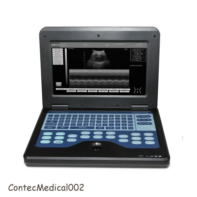 Portable laptop machine Digital Ultrasound scanner, Free 3.5Mhz Convex probe,USA 6945040100362 DIAGNOSTIC ULTRASOUND MACHINES FOR SALE