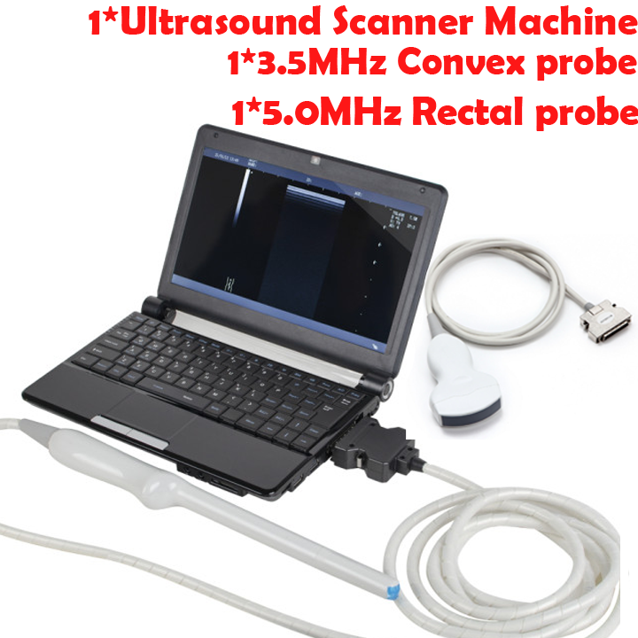 TFT LCD Digital Laptop Linear Array &Cavity Probe Machine Ultrasound Scanner DIAGNOSTIC ULTRASOUND MACHINES FOR SALE