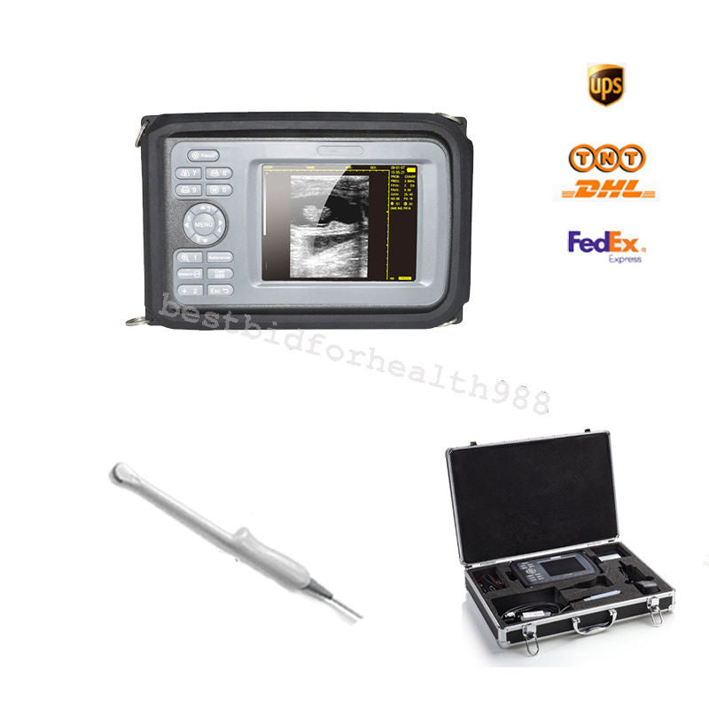 Digital LCD Smartscan Ultrasound Scanner 5.5 Inch & Micro-convex Probe F Traval DIAGNOSTIC ULTRASOUND MACHINES FOR SALE