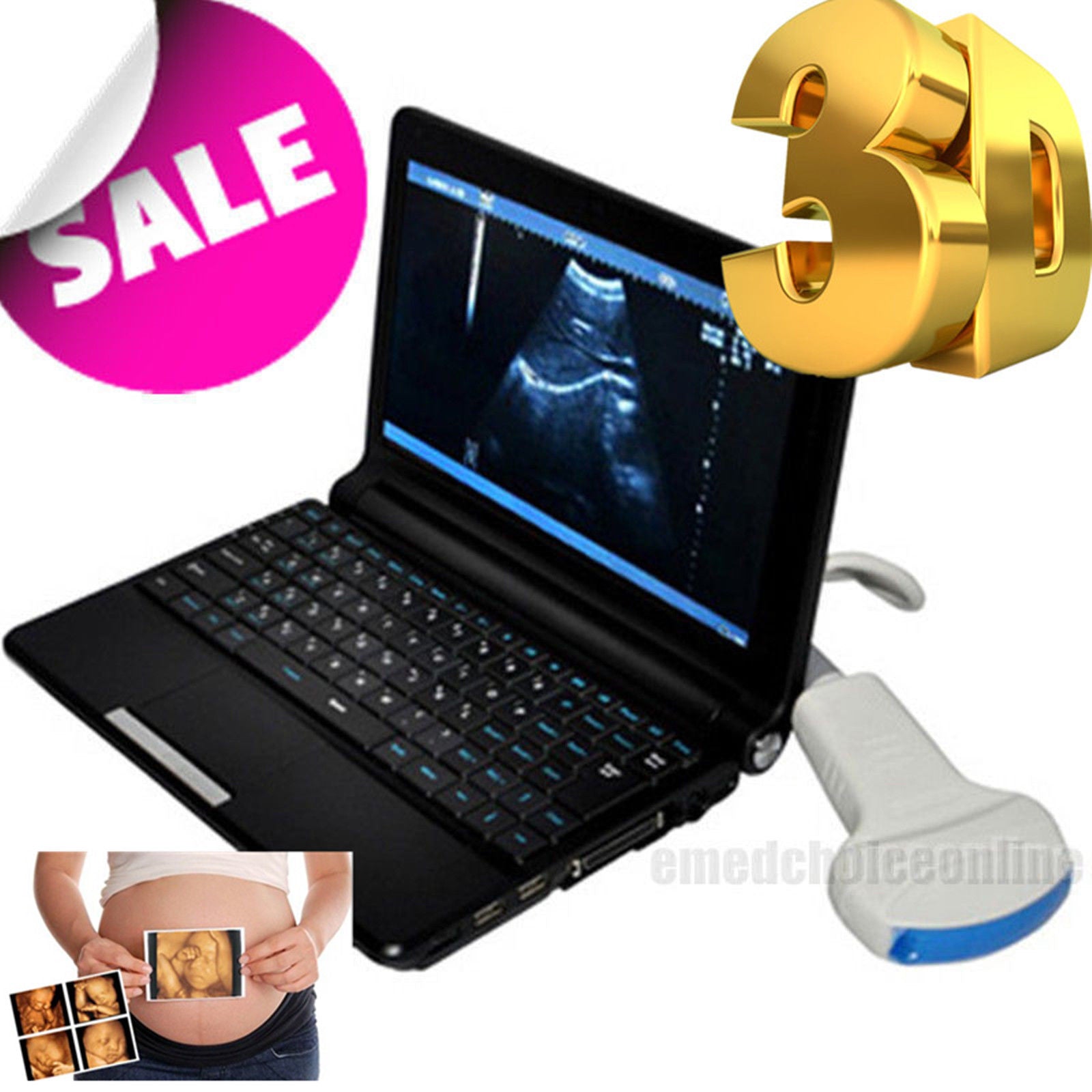 Good Full Digital Quality Version Ultrasound Scanner + Convex or Linear Probe+3D DIAGNOSTIC ULTRASOUND MACHINES FOR SALE