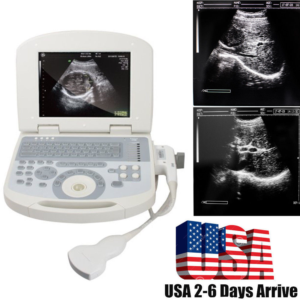 USA! Portable Digital Laptop Medical Ultrasound Scanner Convex Probe 3D New Gift 190891422491 DIAGNOSTIC ULTRASOUND MACHINES FOR SALE