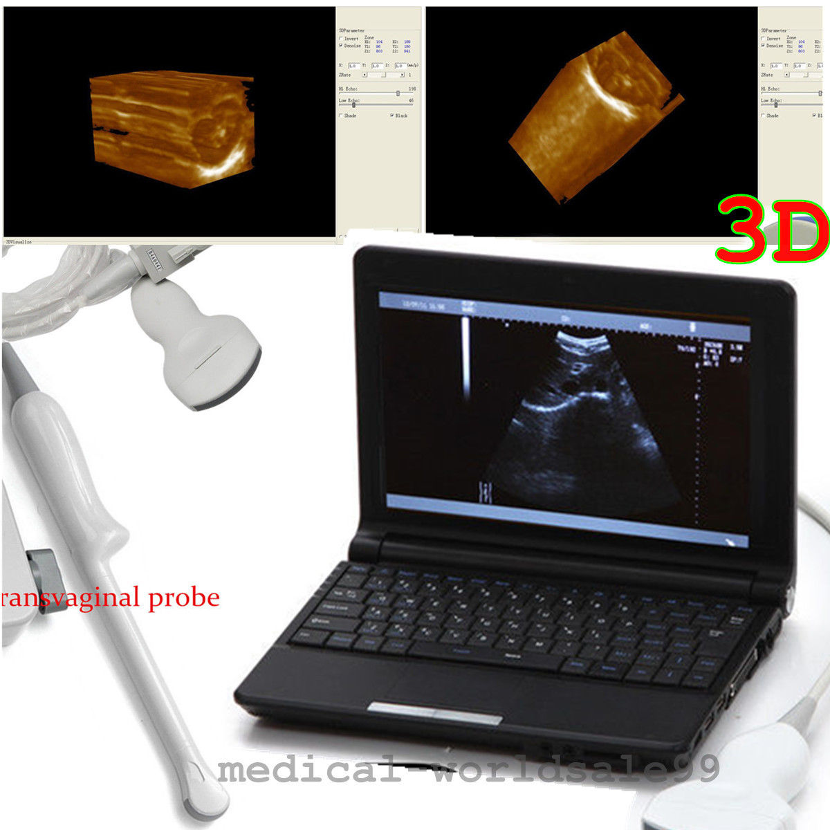 Laptop 10.1 Portable Ultrasound Scanner/Machin +Convex+Transvaginal 2 Probe Sale DIAGNOSTIC ULTRASOUND MACHINES FOR SALE