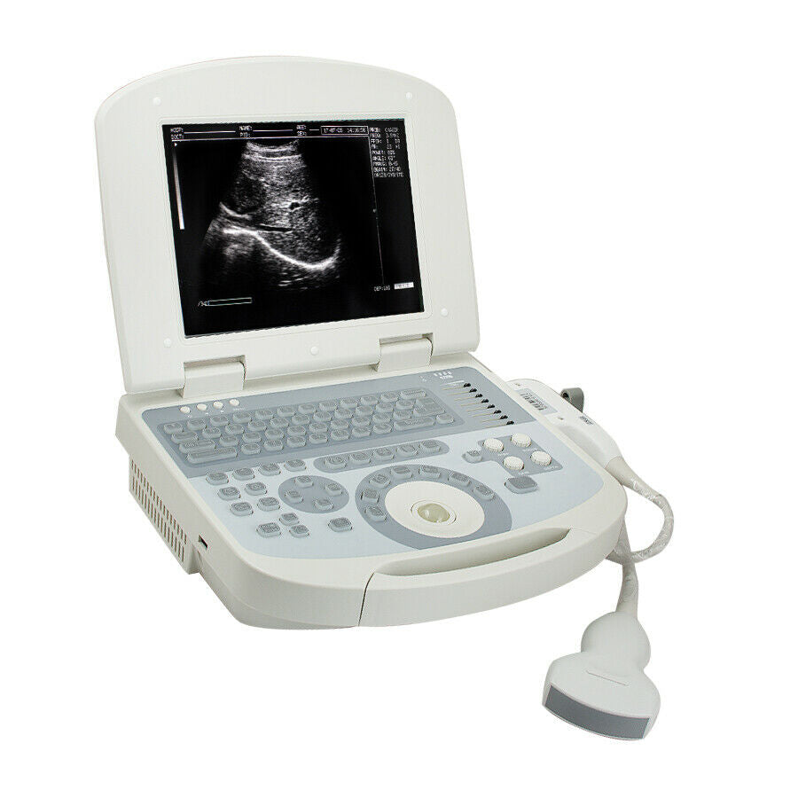 USA Medical Portable Full Digital Laptop Ultrasound Scanner System Convex probe DIAGNOSTIC ULTRASOUND MACHINES FOR SALE