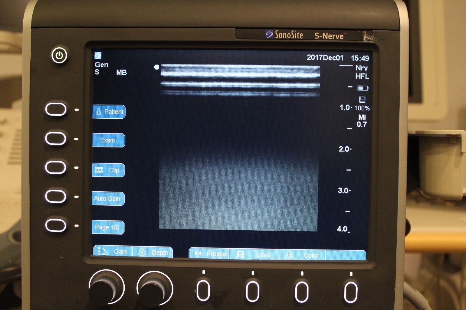 Sonosite S-Nerve vascular/nerve ultrasound with HFL38x-13-6 MHz transducer DIAGNOSTIC ULTRASOUND MACHINES FOR SALE