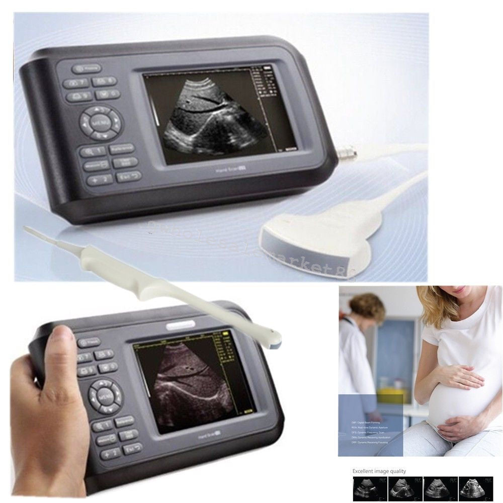 US Laptop Machine Digital Ultrasound Scanner Convex + Linear+ Transvaginal Probe 190891696984 DIAGNOSTIC ULTRASOUND MACHINES FOR SALE