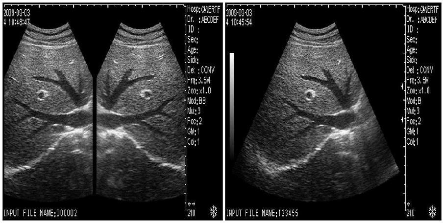 Ultrasound Scanner Machine with Micro-convex Transrectal Probe 3D Good Image 190891875310 DIAGNOSTIC ULTRASOUND MACHINES FOR SALE