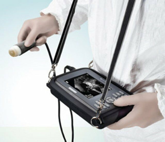 Portable Diagnostic Ultrasound Machine ultrasound Scanner System Convex Probe US DIAGNOSTIC ULTRASOUND MACHINES FOR SALE