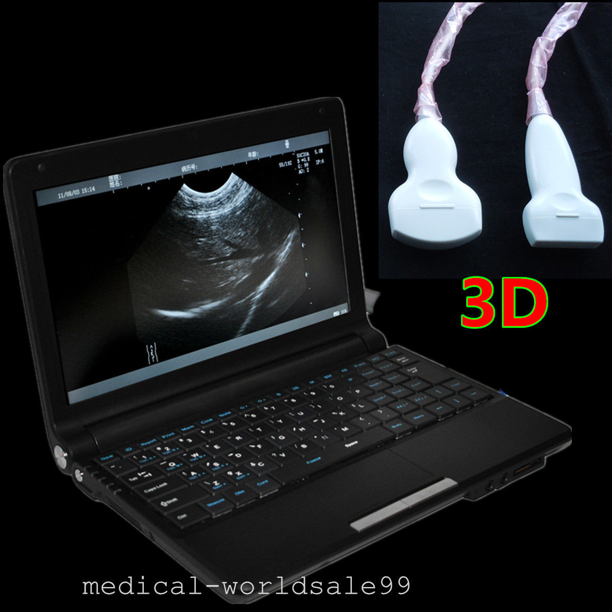 Laptop 10.1 Portable Ultrasound Scanner/Machin +Convex+Transvaginal 2 Probe Sale DIAGNOSTIC ULTRASOUND MACHINES FOR SALE