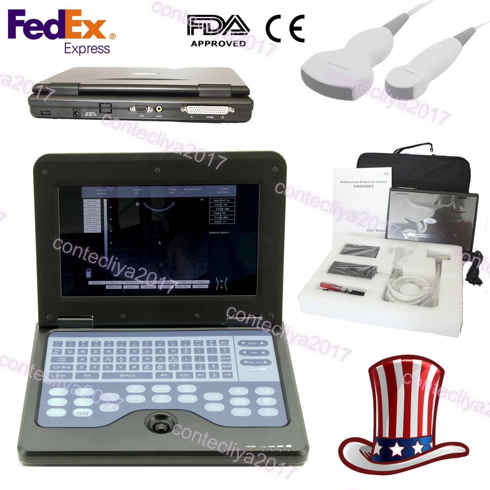 USA,Portable Ultrasound Scanner Laptop Machine Convex/Linear/Cardiac/Tranvaginal DIAGNOSTIC ULTRASOUND MACHINES FOR SALE