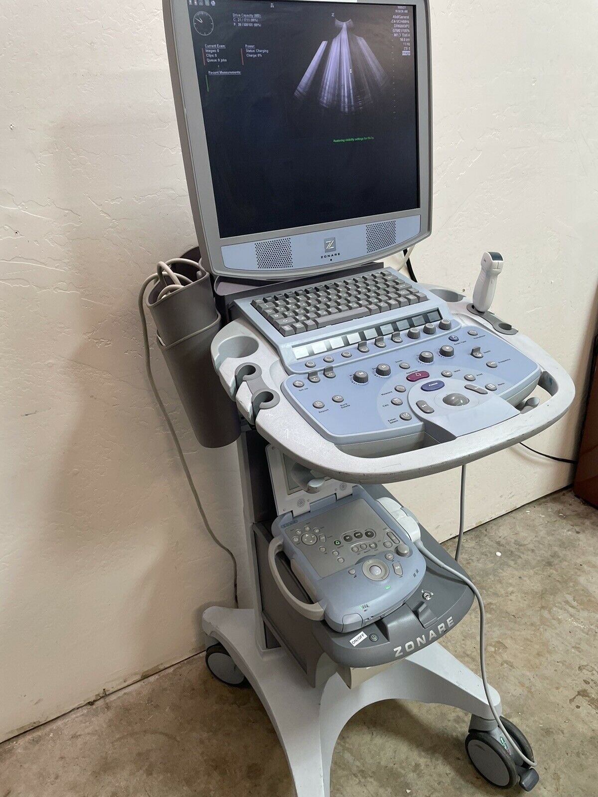 Zonare Z One Ultrasound System With Transducer And Printer DIAGNOSTIC ULTRASOUND MACHINES FOR SALE