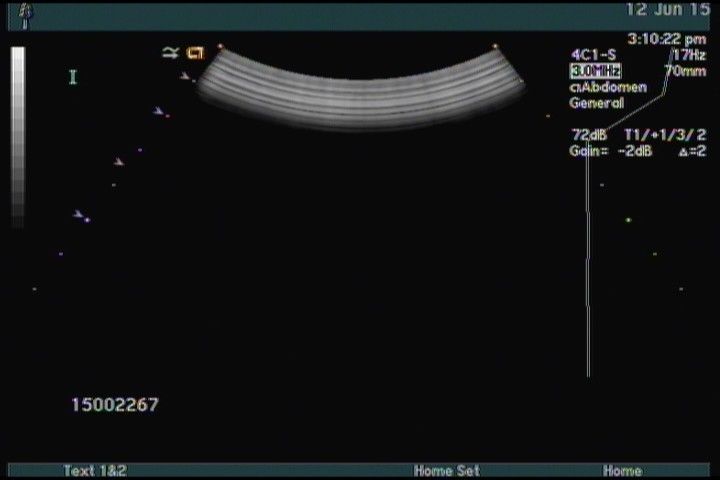 Siemens ACUSON 4C1 Ultrasound Transducer DIAGNOSTIC ULTRASOUND MACHINES FOR SALE