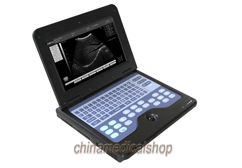 With Convex &Cardiac Sensors Digital Ultrasound Scanner Ultrasonic Machine USA DIAGNOSTIC ULTRASOUND MACHINES FOR SALE