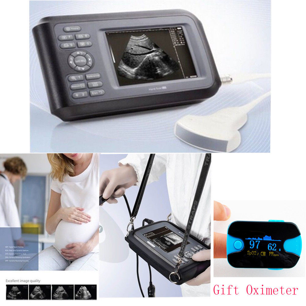 USA Human Laptop Ultrasound Scanner Machine 3.5MHZ Convex Probe + Gift Oximeter 190891054043 DIAGNOSTIC ULTRASOUND MACHINES FOR SALE