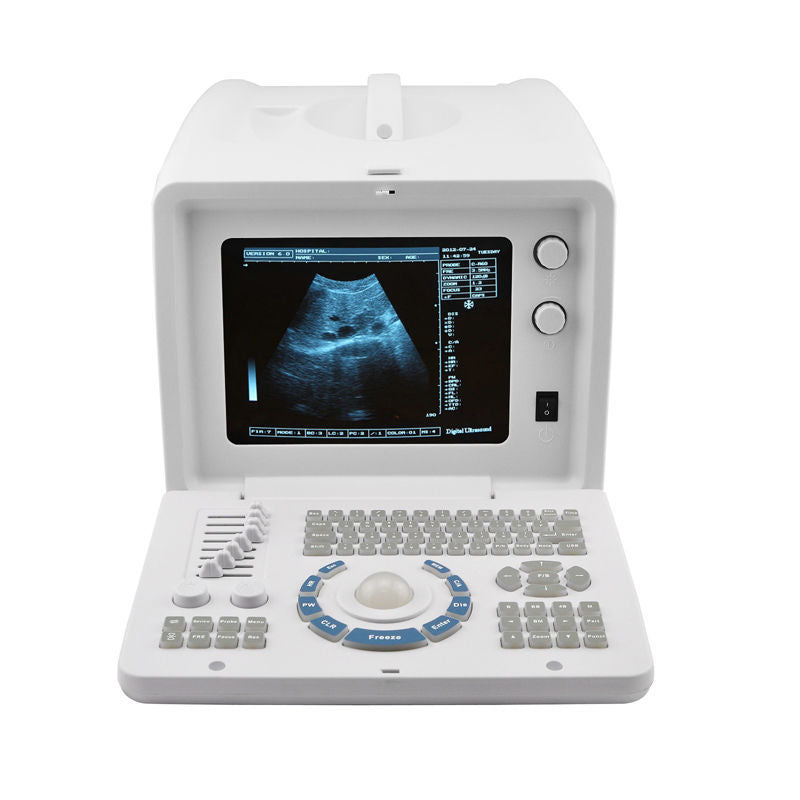 Clear Ultrasound Scanner RUS-6000D with Convex+Transvaginal Probe DIAGNOSTIC ULTRASOUND MACHINES FOR SALE