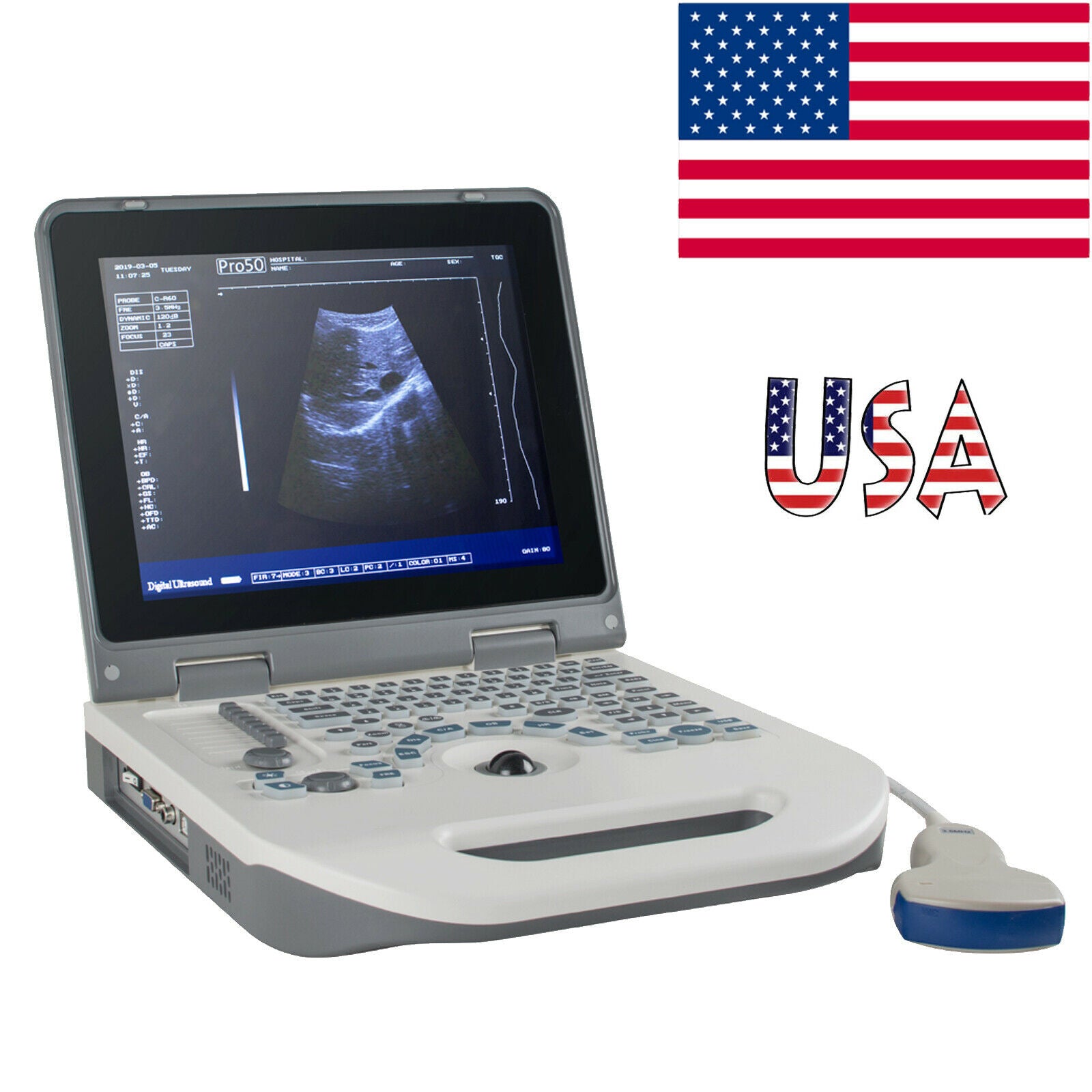 U 3.5Mhz Notebook Full Digital Ultrasound Scanner Diagnostic System Convex Probe DIAGNOSTIC ULTRASOUND MACHINES FOR SALE