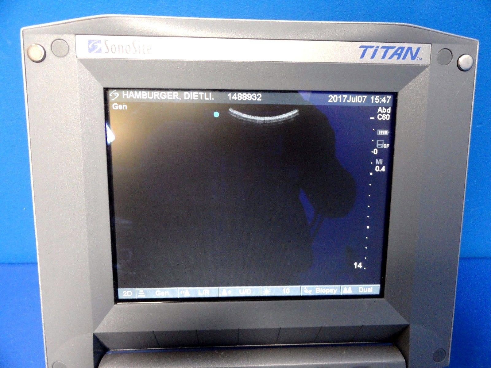 SONOSITE TITAN Ultrasound W/ C60/5-2 Convex Array & ICT/8-5MHz Transducer ~12904 DIAGNOSTIC ULTRASOUND MACHINES FOR SALE