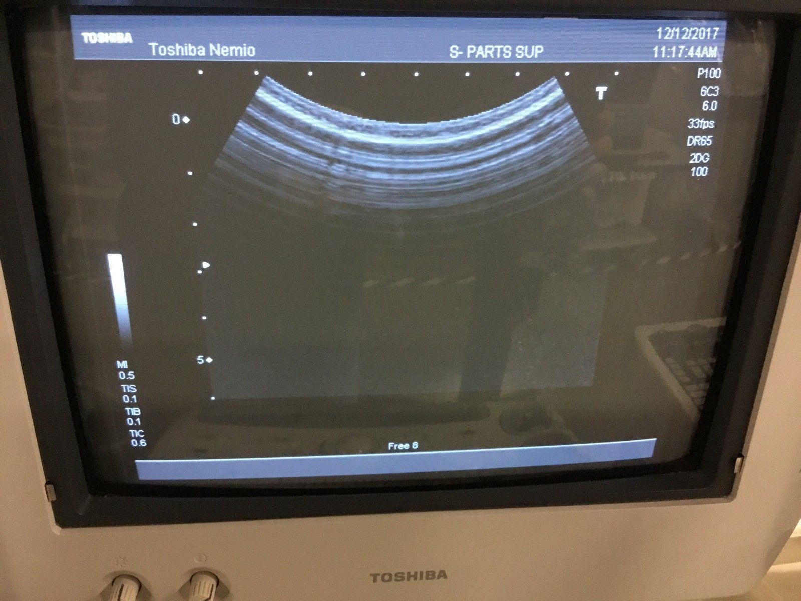 Toshiba PVM-375AT Ultrasound Probe DIAGNOSTIC ULTRASOUND MACHINES FOR SALE