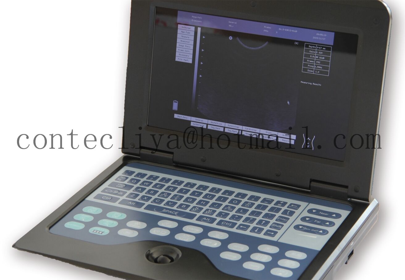 Portable Laptop Ultrasound Machine Digital Diagnostic System,Convex+Transvaginal DIAGNOSTIC ULTRASOUND MACHINES FOR SALE