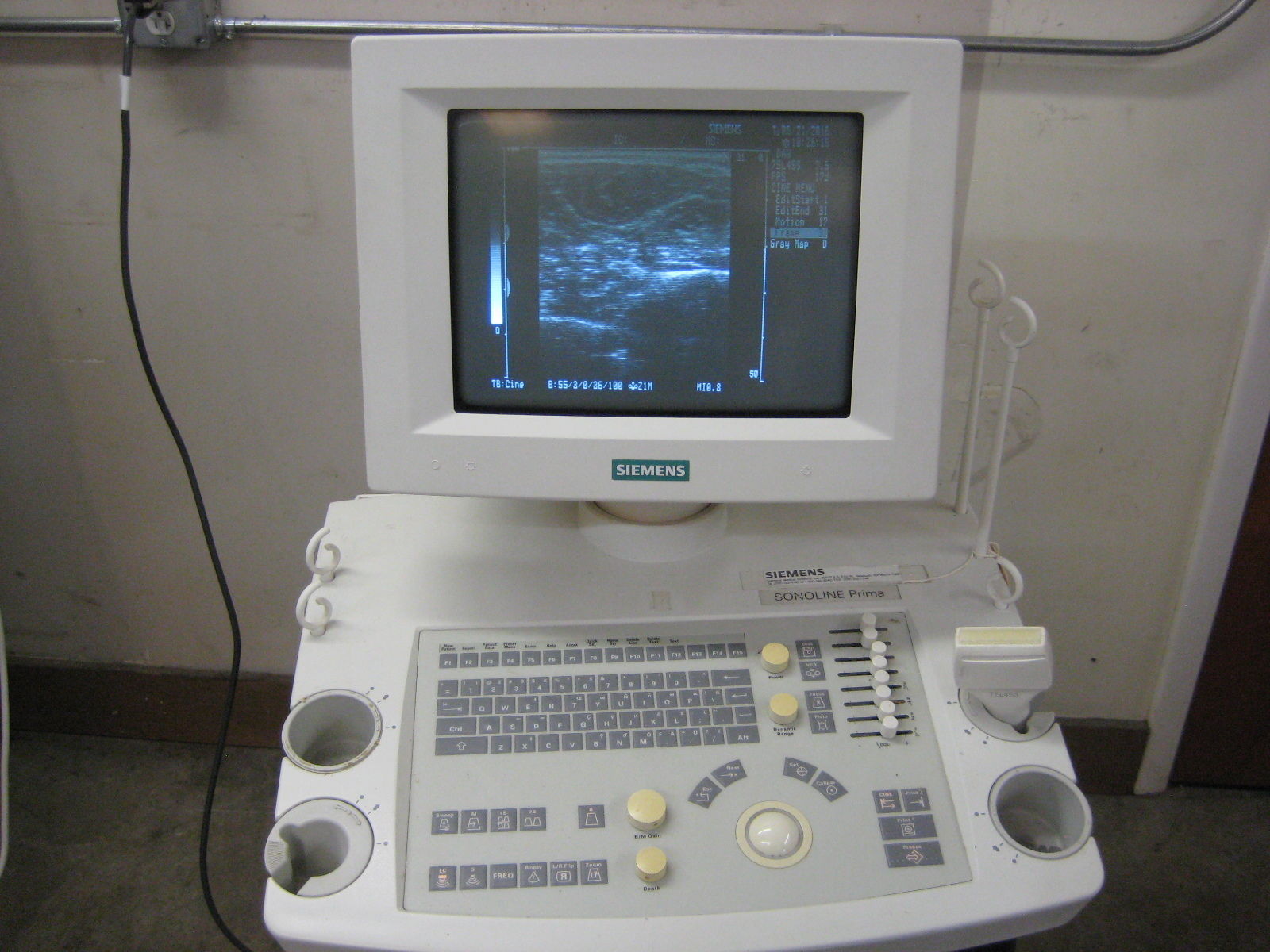 Siemens Sonoline Prima Ultrasound with Linear probe and printer.  Guaranteed DIAGNOSTIC ULTRASOUND MACHINES FOR SALE