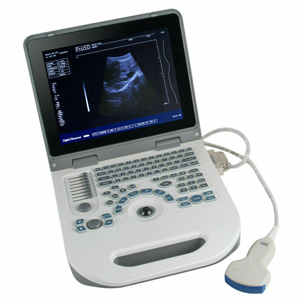 U 3.5Mhz Notebook Full Digital Ultrasound Scanner Diagnostic System Convex Probe DIAGNOSTIC ULTRASOUND MACHINES FOR SALE