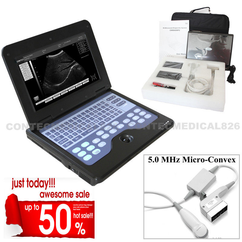 CE Portable Ultrasound Scanner Laptop Machine Diagnostic System Optional 4 Probe DIAGNOSTIC ULTRASOUND MACHINES FOR SALE