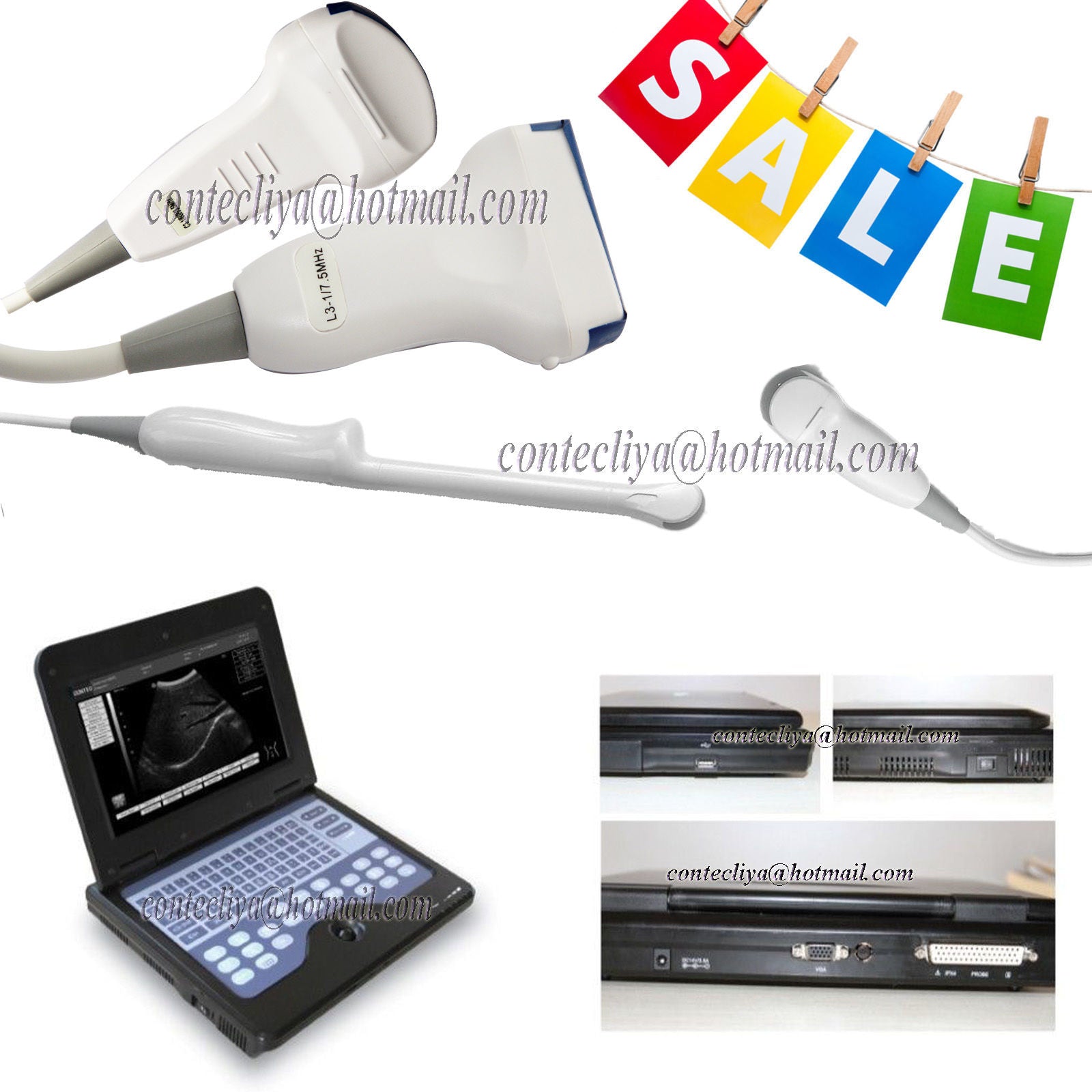 CE Digital Ultrasound Scanner Laptop Machine Diagnostic System Optional 4 Probe DIAGNOSTIC ULTRASOUND MACHINES FOR SALE