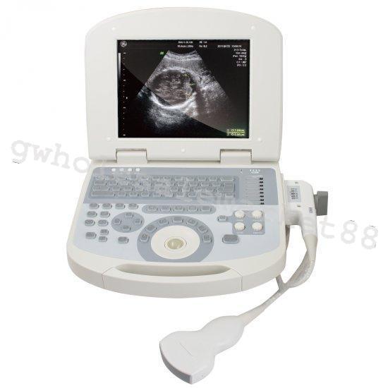 US Notebook Ultrasound Machine Scanner System Convex Probe +3D Software Portable 190891422491 DIAGNOSTIC ULTRASOUND MACHINES FOR SALE